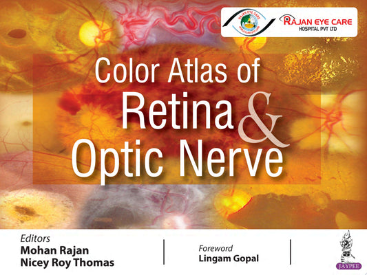 Color Atlas of Retina and Optic Nerve