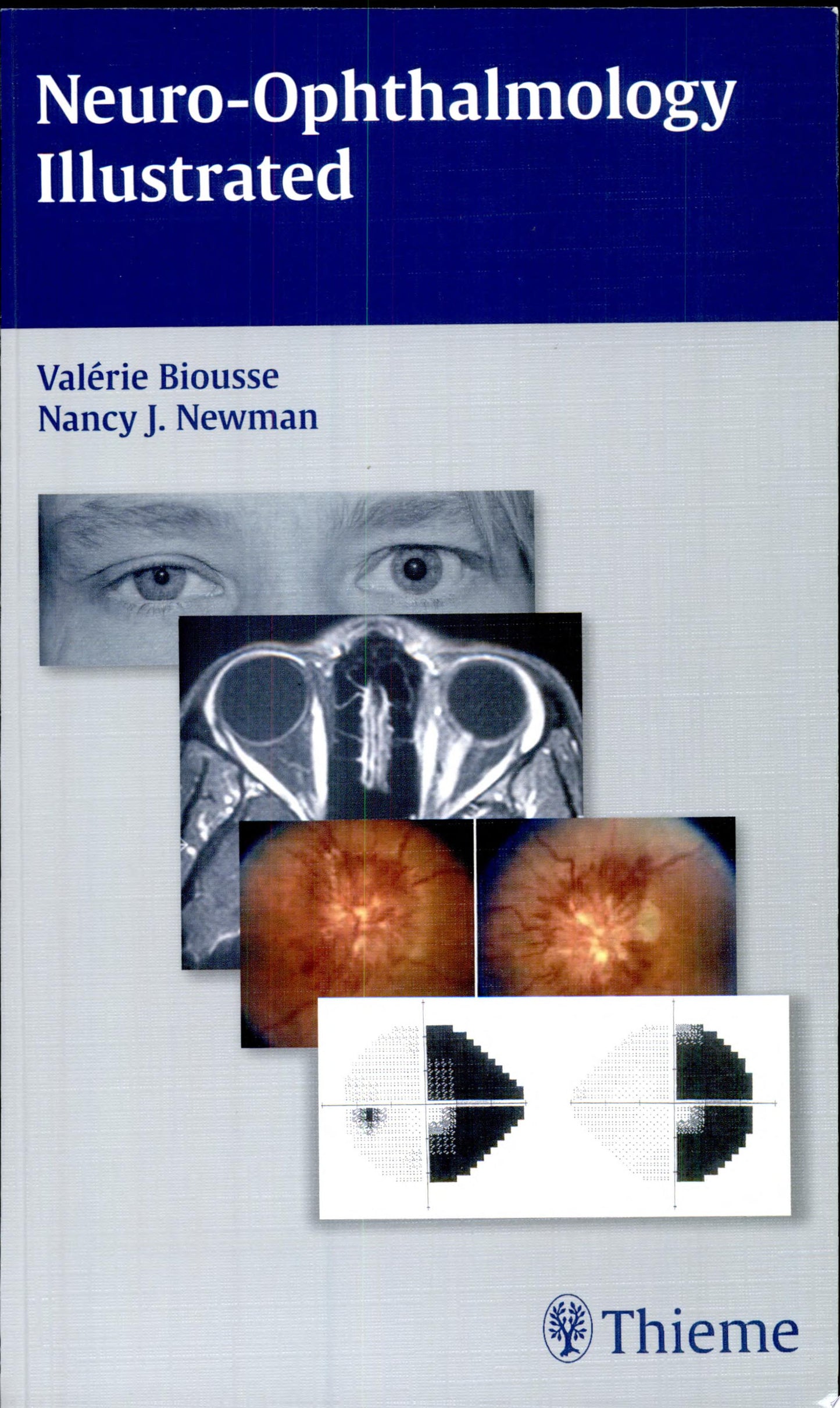 Neuro-Ophthalmology Illustrated, 2nd Edition