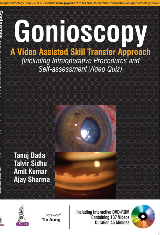 Gonioscopy:A Video Assisted Skill Transfer Approach