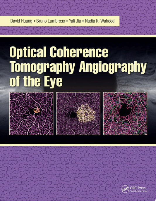 Optical Coherence Tomography Angiography of the Eye, 2nd edition