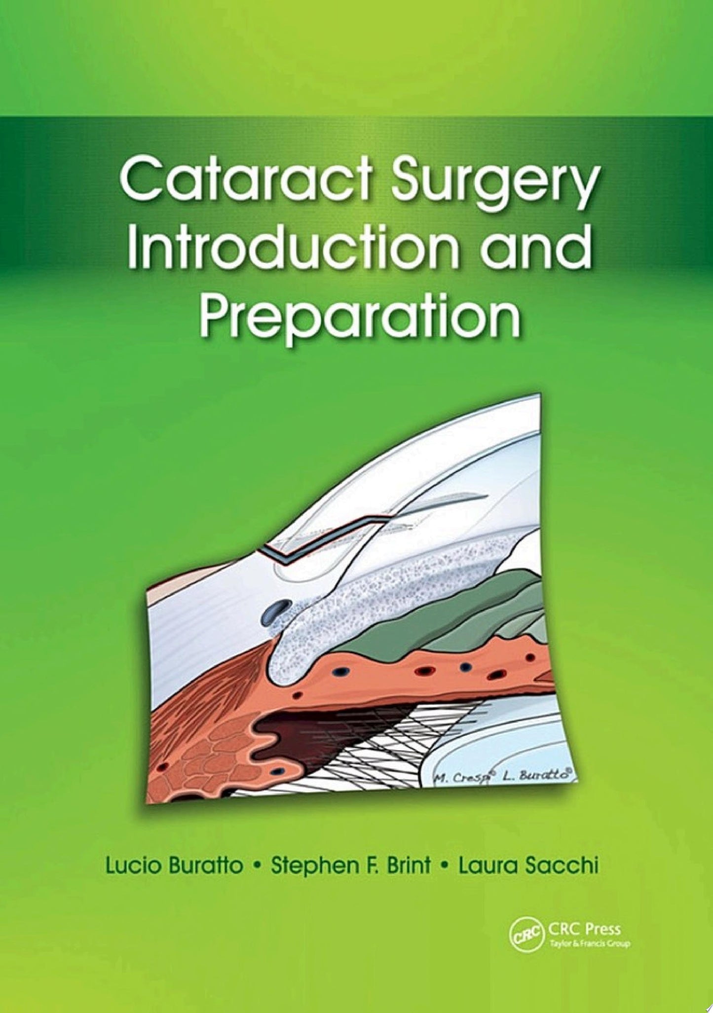 Cataract Surgery: Introduction and Preparation