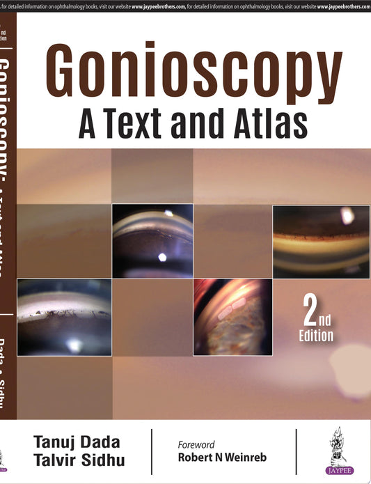 Gonioscopy: A Text and Atlas, 2nd Edition