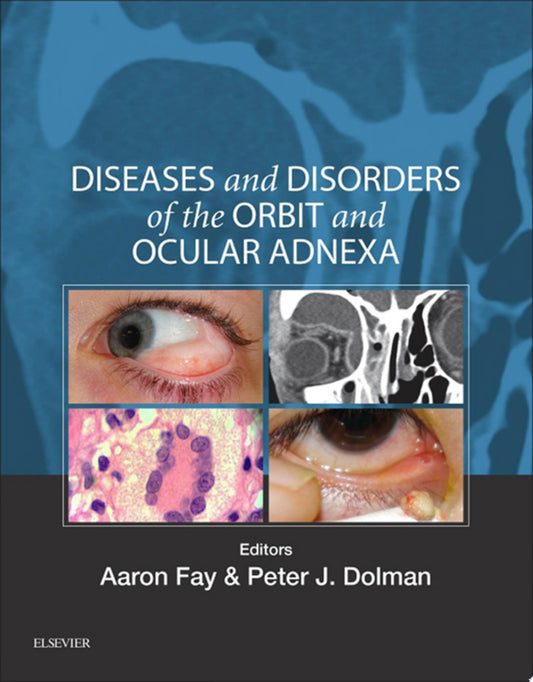 Diseases and Disorders of the Orbit and Ocular Adnexa, 1e