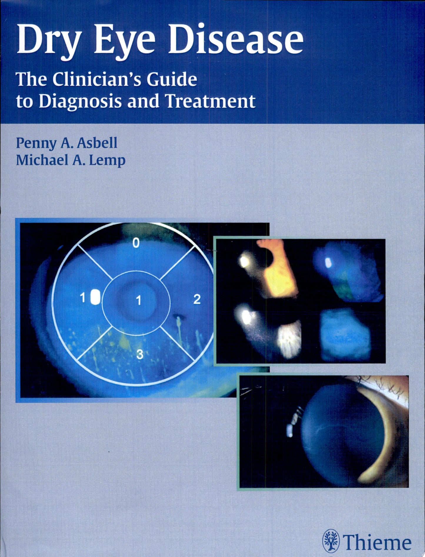 Treatment Of Dry Eye