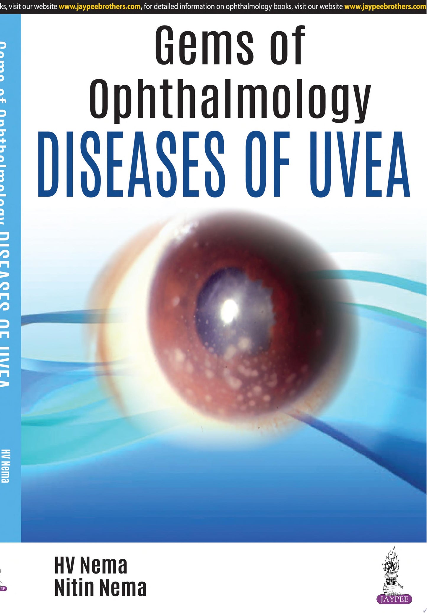 Gems of Ophthalmology-Diseases of Uvea