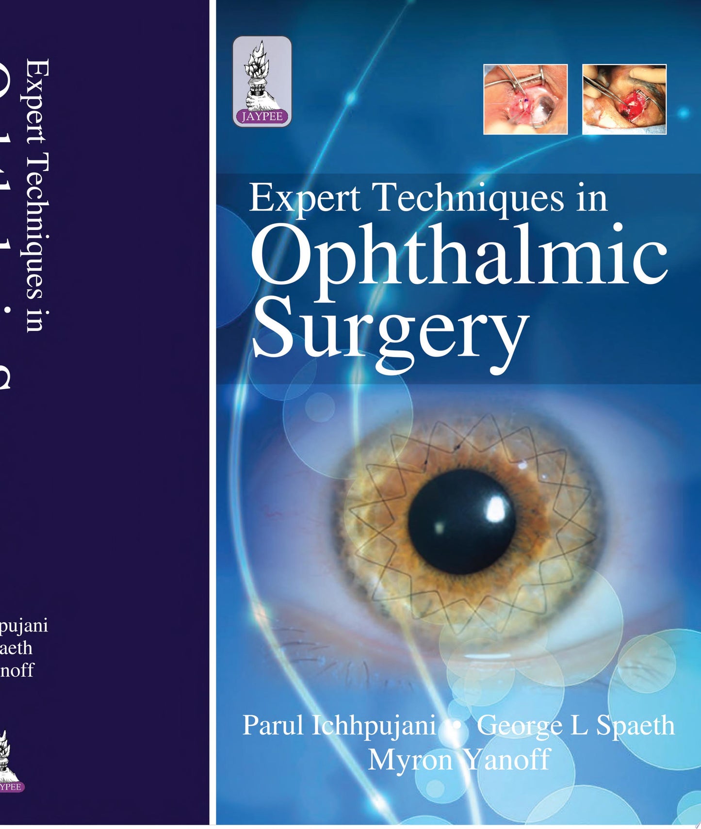 Expert Techniques in Ophthalmic Surgery, 2nd edition