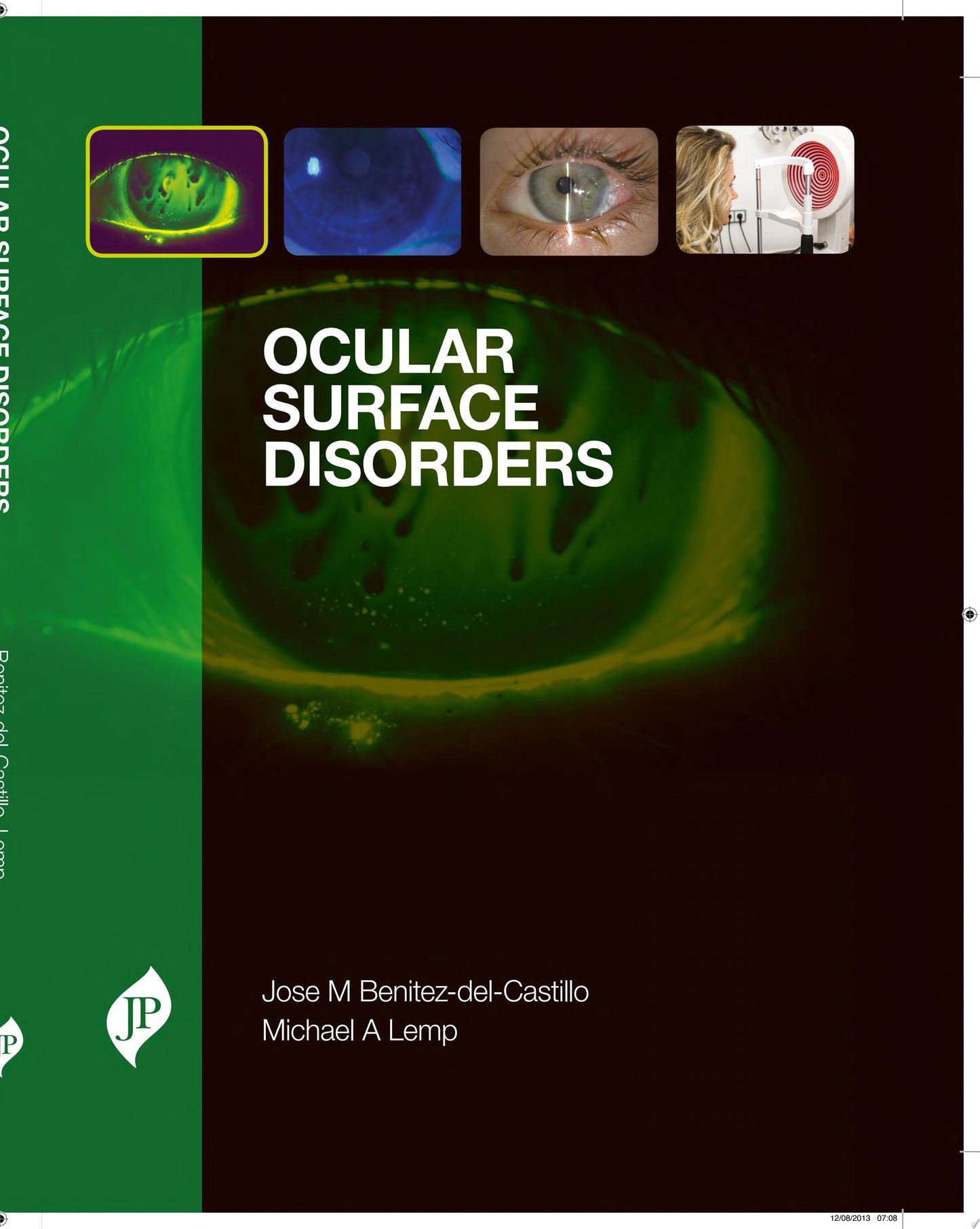 Disorders of Cornea and Ocular Surface