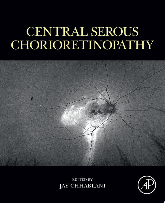 Central Serous Chorioretinopathy