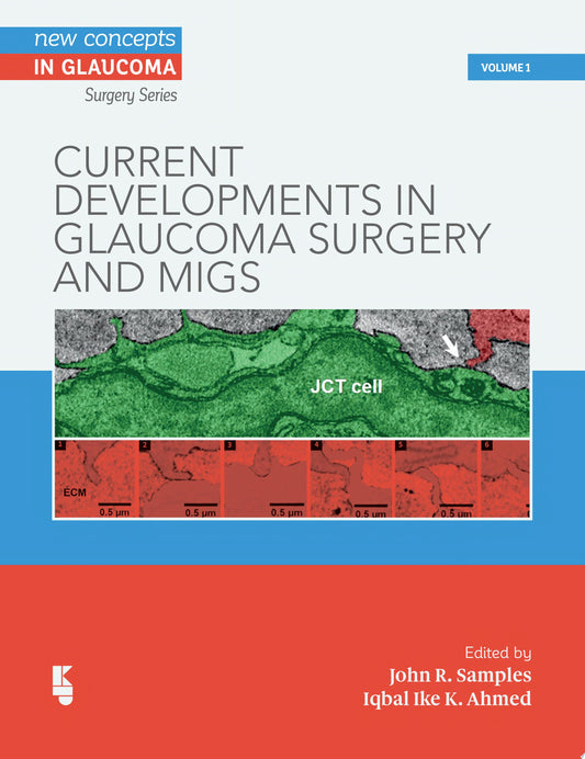 Current Developments in Glaucoma Surgery and MIGS: 3