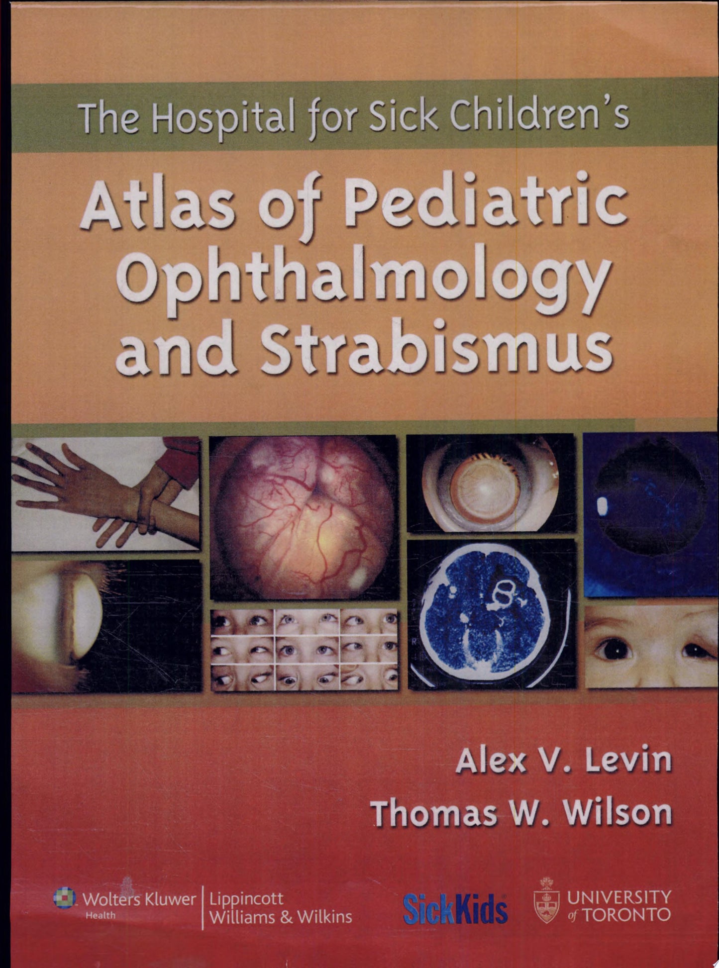 The Hospital for Sick Children’s Atlas of Pediatric Ophthalmology and Strabismus