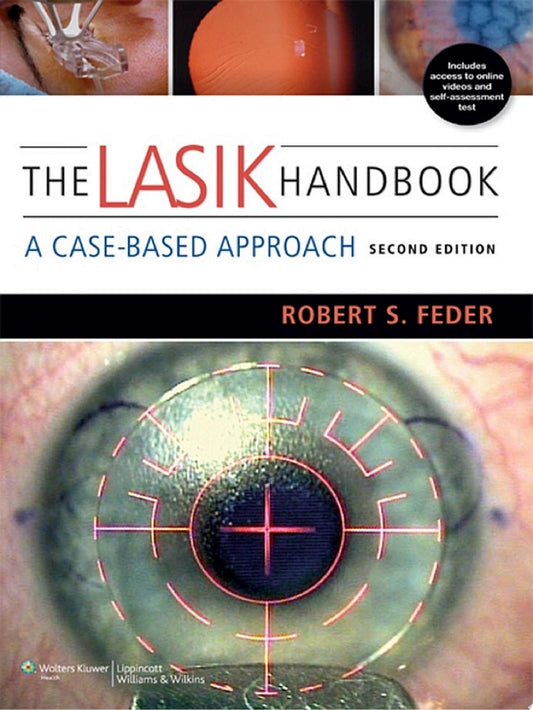The LASIK Handbook: A Case-Based Approach, 2nd Edition