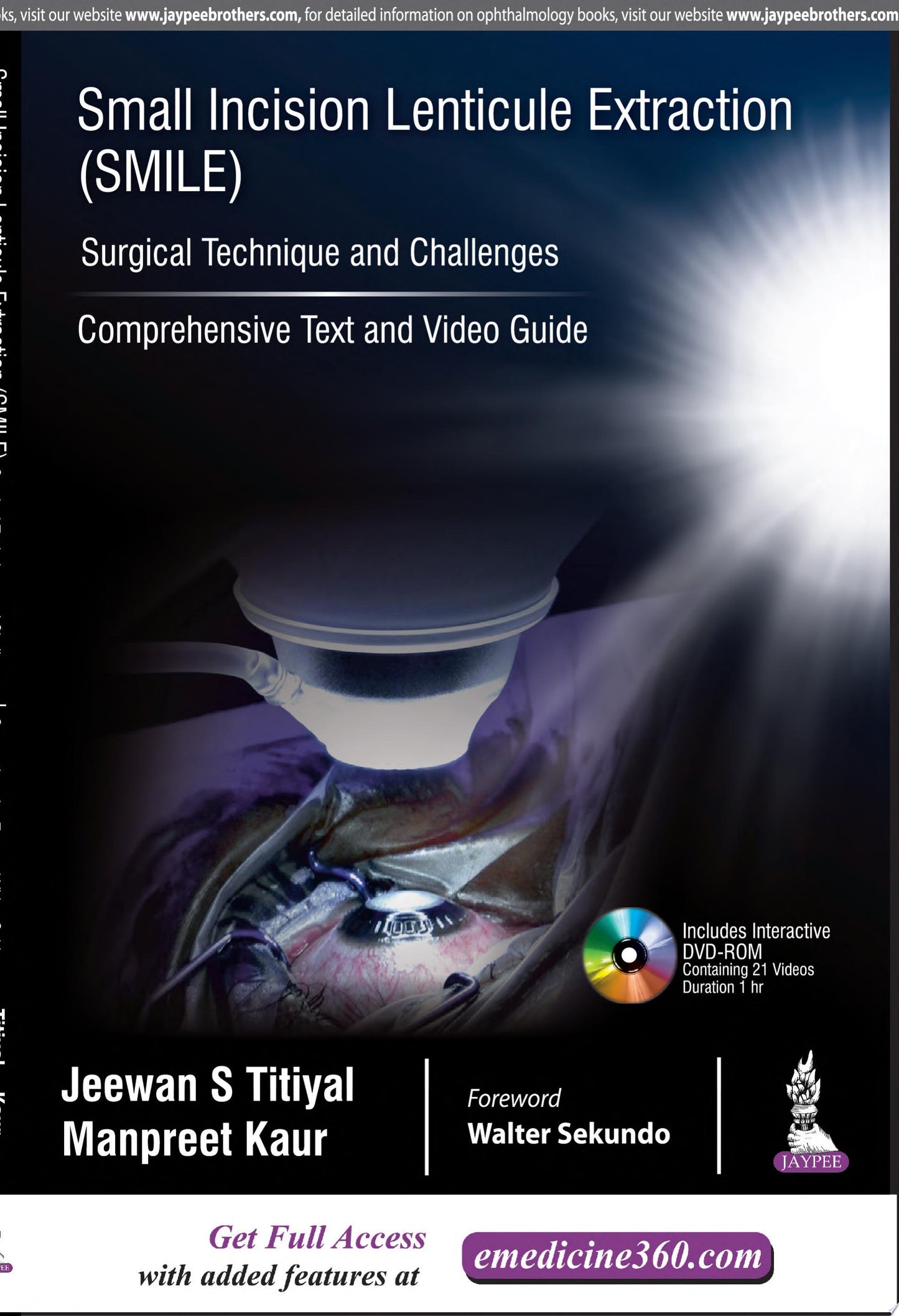 Small Incision Lenticule Extraction : Surgical Technique and Challenges
