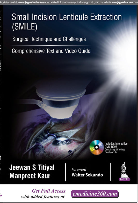 Small Incision Lenticule Extraction : Surgical Technique and Challenges