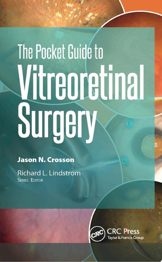 Pocket Guide to Vitreoretinal Surgery