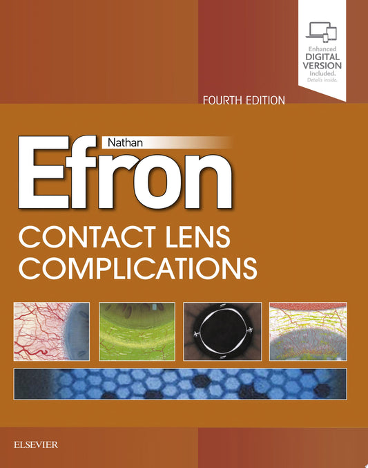 Contact Lens Complications 4th Edition