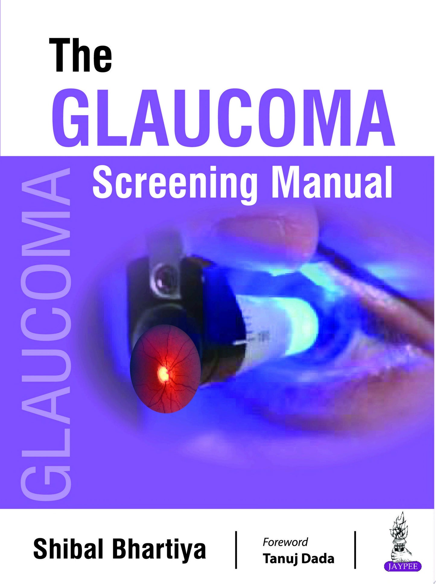 The Glaucoma Screening Manual
