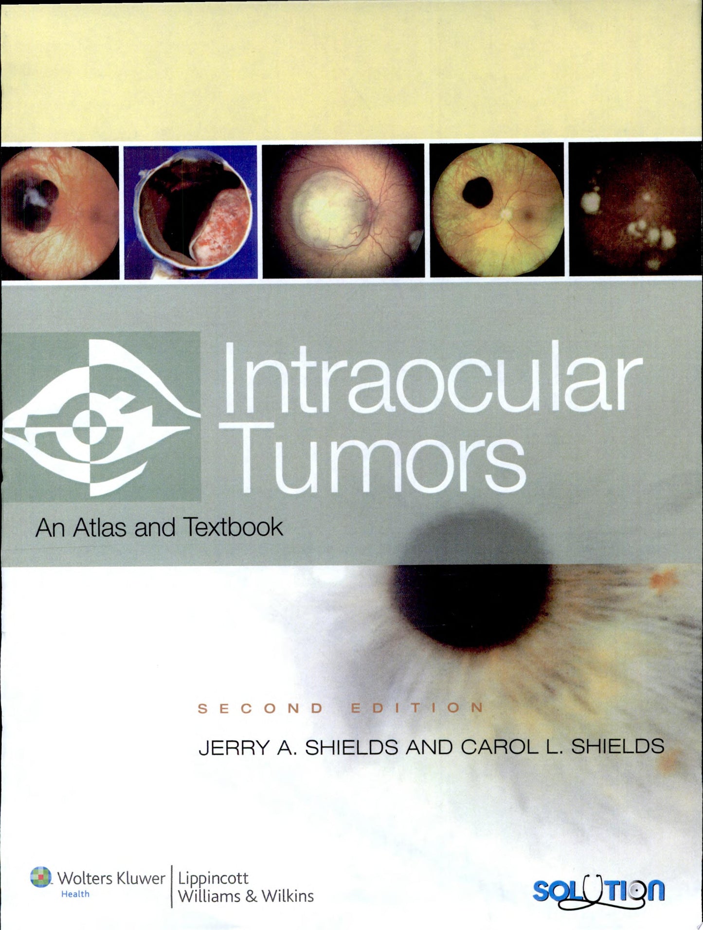 Intraocular Tumors: An Atlas and Textbook