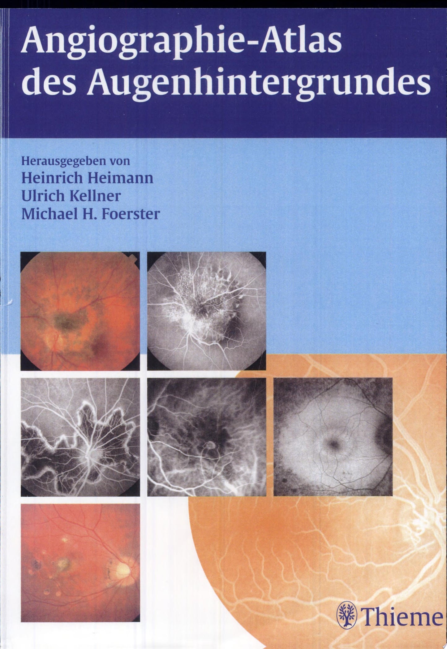 Atlas of Fundus Angiography