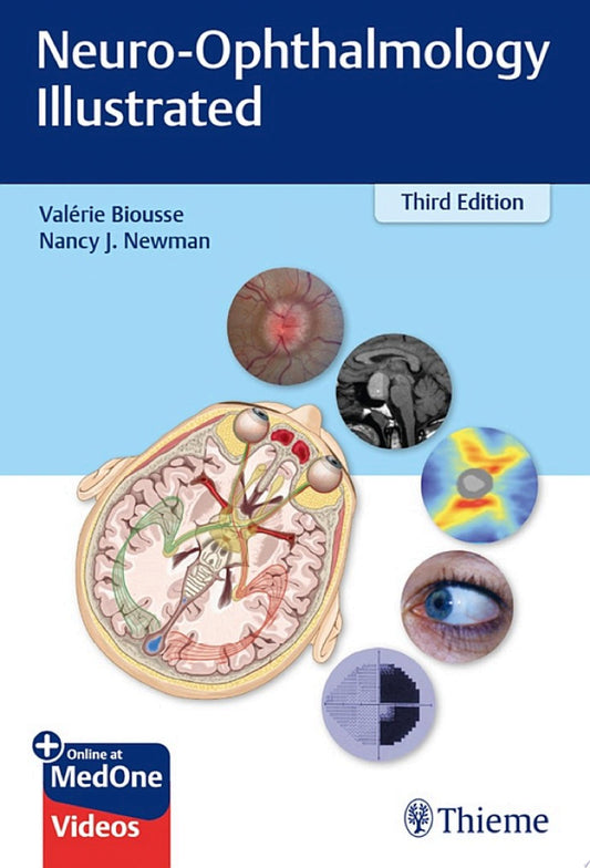 Neuro-Ophthalmology Illustrated, 3rd Edition