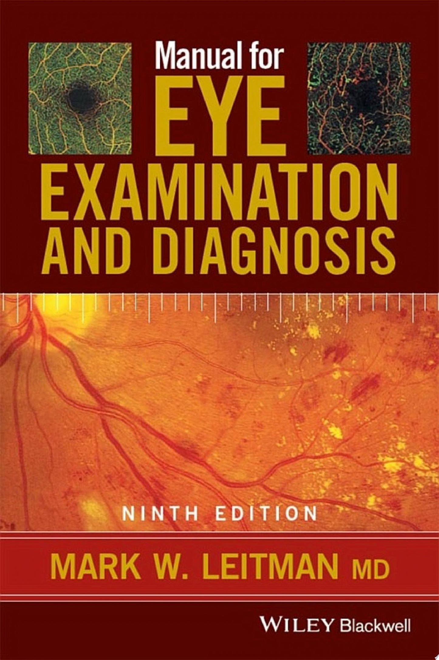 Manual for Eye Examination and Diagnosis