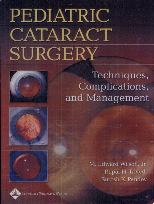 Pediatric Cataract Surgery: Techniques, Complications and Management