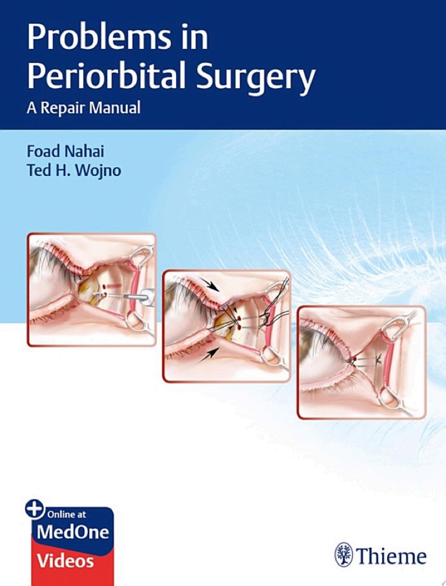 Problems in Periorbital Surgery: A Repair Manual