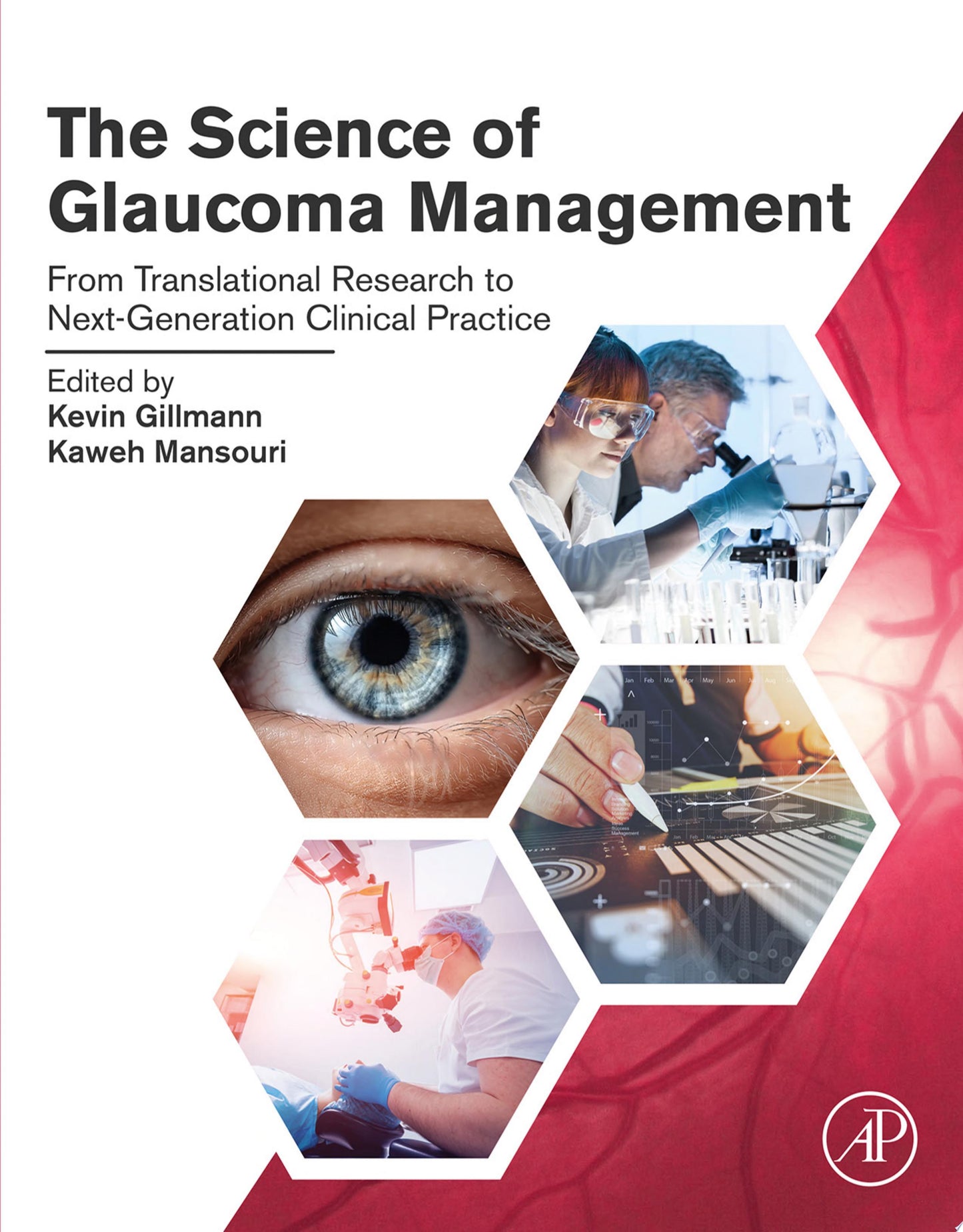 The Science of Glaucoma Management: From Translational Research to Next-Generation Clinical Practice