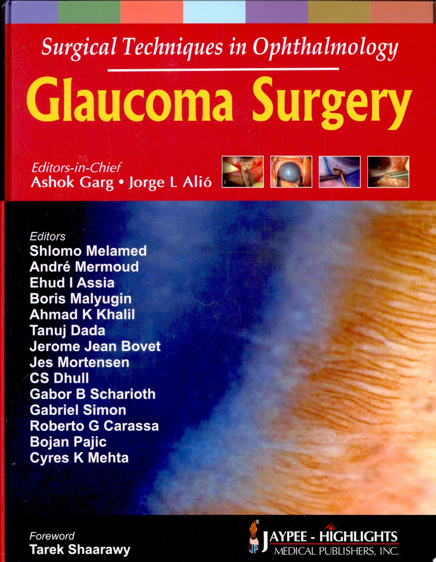 Glaucoma Surgery