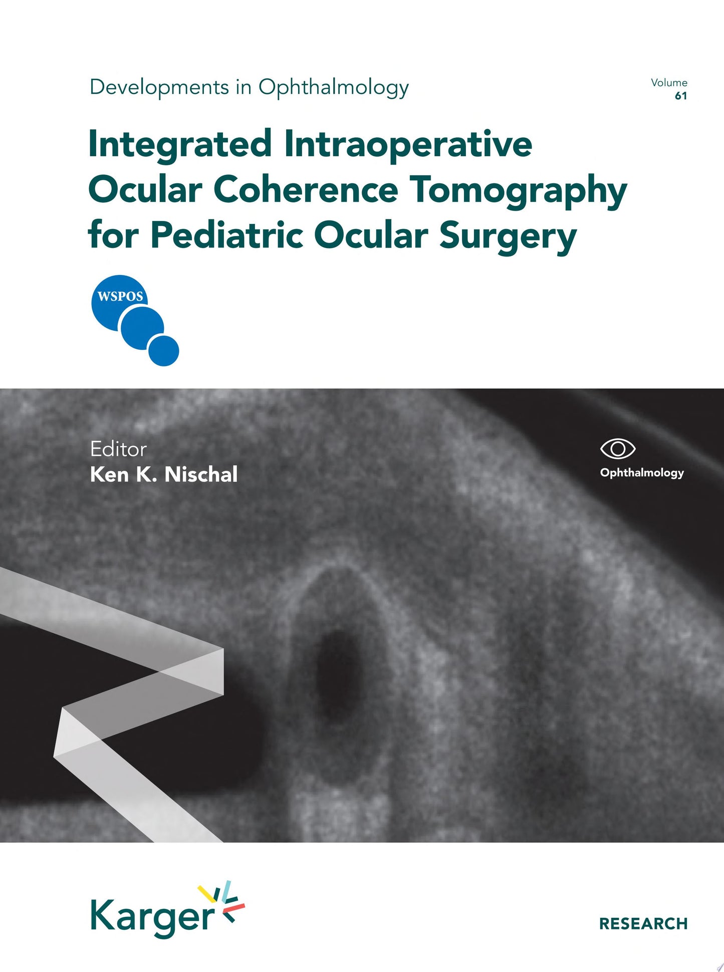 Integrated Intraoperative Ocular Coherence Tomography for Pediatric Ocular Surgery