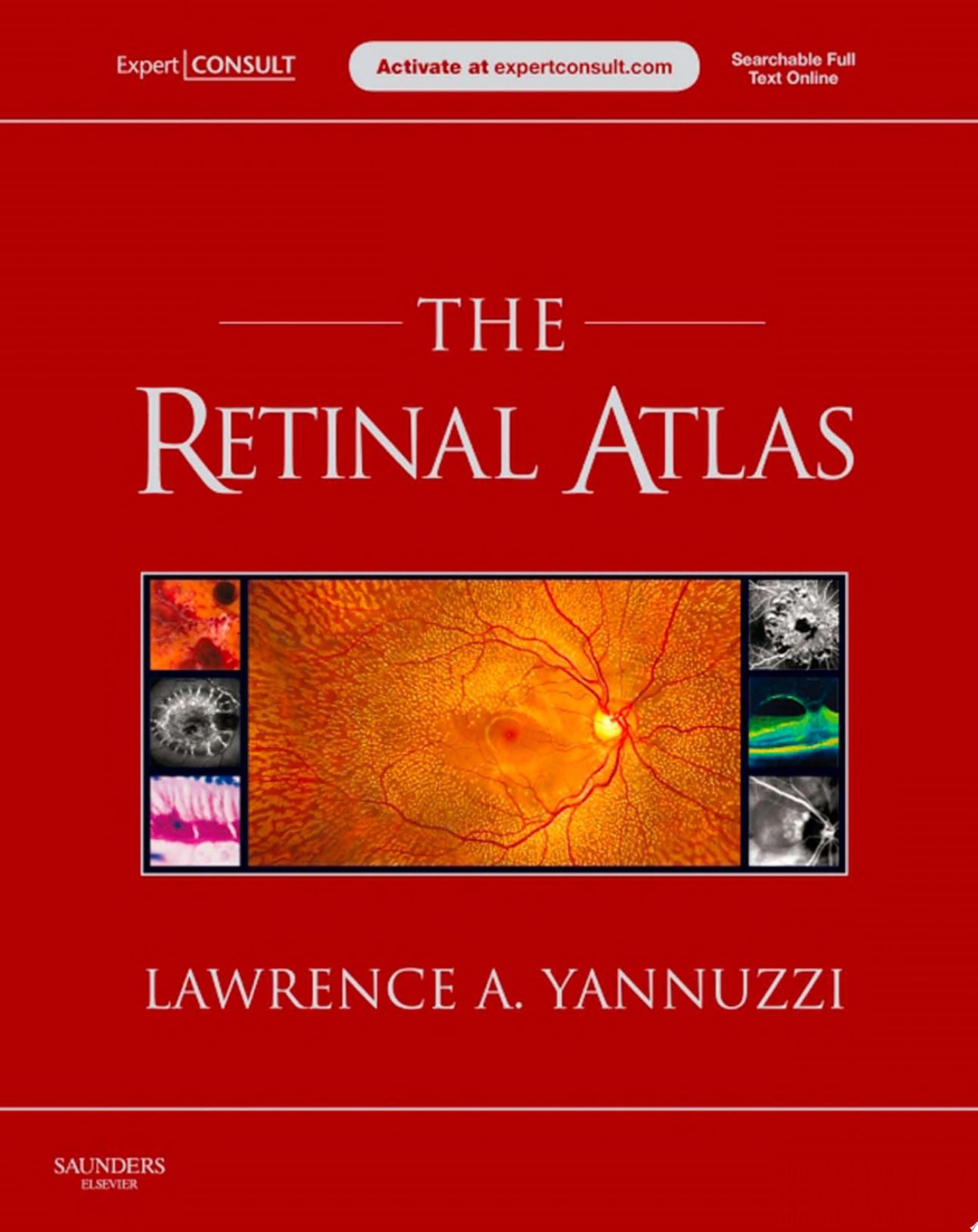 Retina Atlas