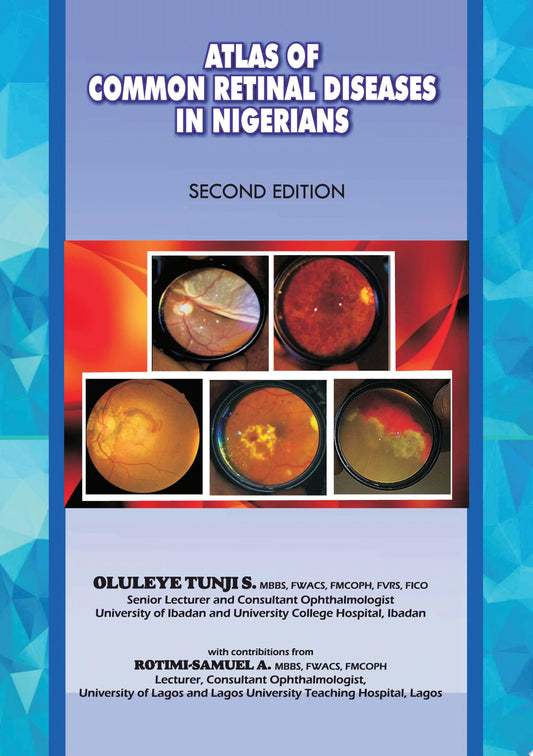 The Atlas of Retinal Diseases in Nigerians