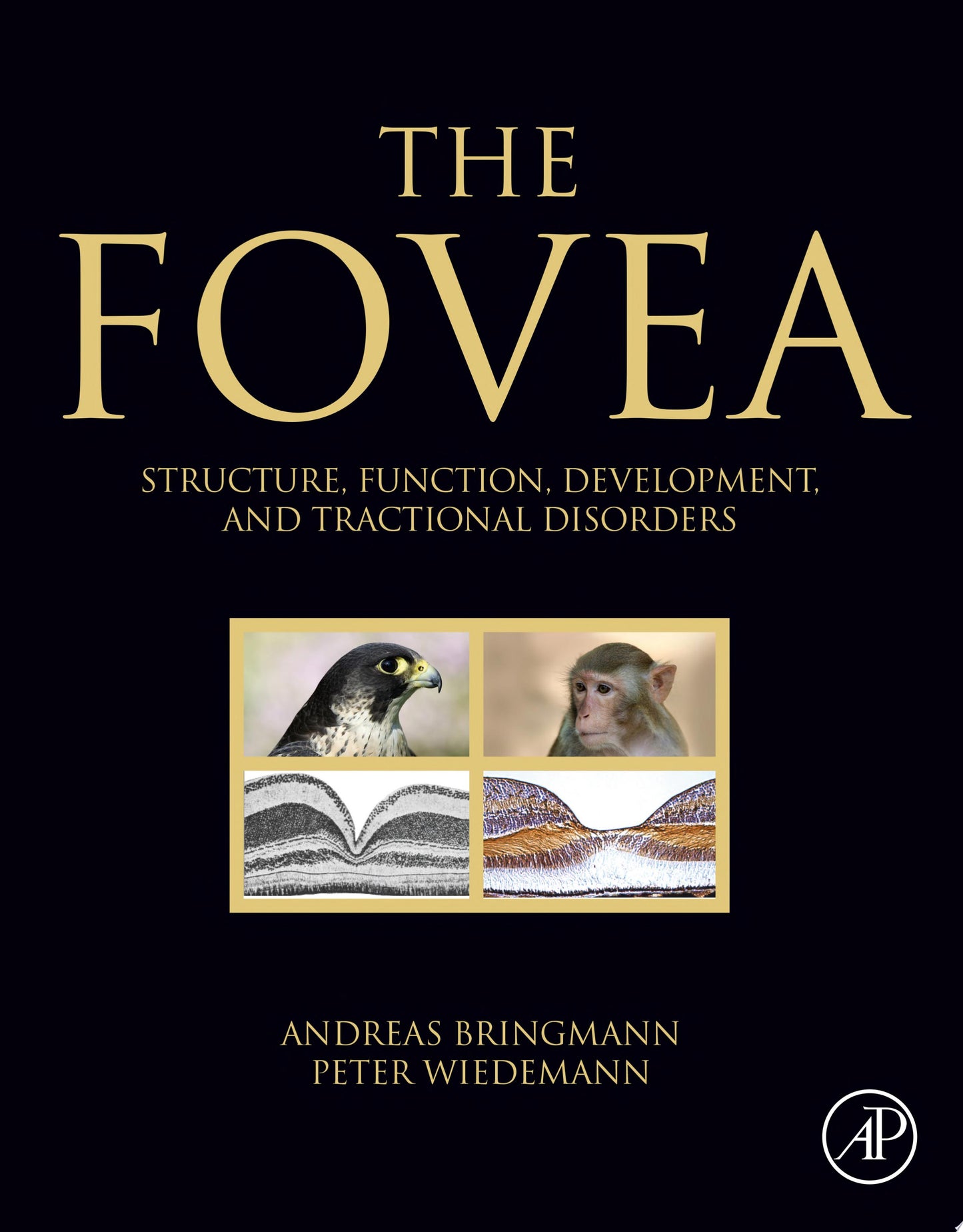 The Fovea: Structure, Function, Development, and Tractional Disorders